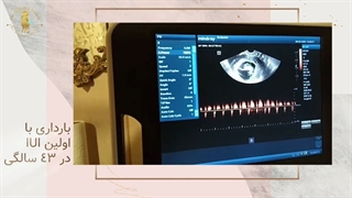 چرا باورش نمیشه بارداره !؟