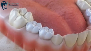 حفظ دندان شیری