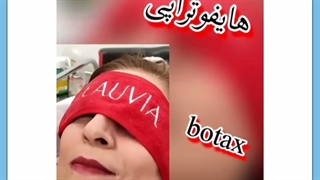 آیا هایفو واقعا تاثیر دارد؟ نتایج بعد از هایفوتراپی