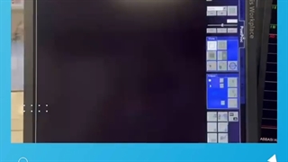 آنژیوپلاستی در سکته حاد قلبی