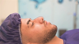 نتیجه جراحی رینوپلاستی