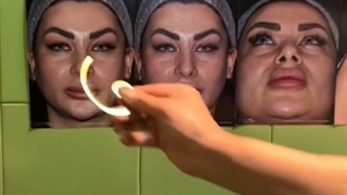 عمل رینوپلاستی