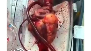 درون جعبه قلب