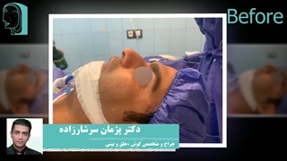 فیلم واقعی عمل بینی مردانه