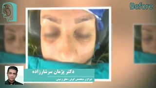 فیلم اتاق عمل جراحی بینی