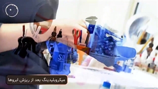 میکروبلیدینگ بعد از ریزش ابروها