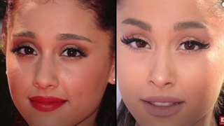 سلبریتی هایی که جراحی بینی انجام داده اند!ً