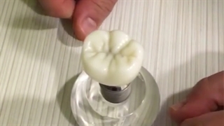 ساختار ایمپلنت