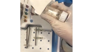 جراحی ایمپلنت فوری همزمان با کشیدن ریشه پوسیده بیمار