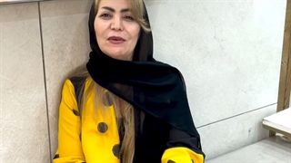 رضایت کاشت ابرو