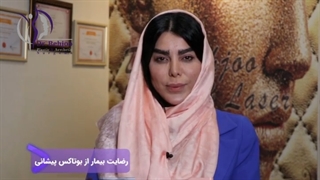 رضایت زیباجو عزیزمون از تزریق بوتاکس