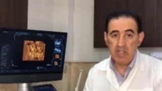 تصویر سونوگرافی سه بعدی از صورت جنین