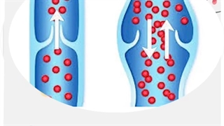 علل تشکیل عروق واریسی | دکتر یاسمین افسری