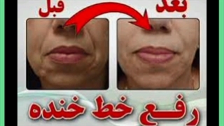 آیا هایفو واقعا تاثیر دارد؟ نتایج بعد از هایفوتراپی