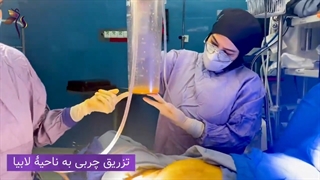 تزریق چربی به ناحیهتناسلی چگونه انجام می شود؟