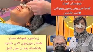 فیلم جراحی بینی بدون بیهوشی در مطب | دکتر محمدعلی حسینی در اهواز