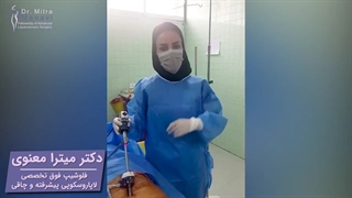 عمل لاپاراسکوپی در فتق کشاله ران