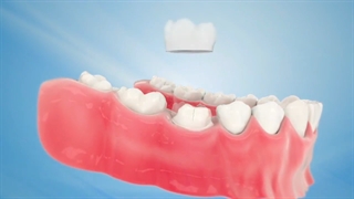 دکتر وحید دهقان : راز سیاهی لثه