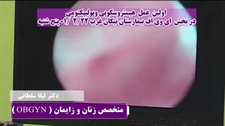 ↩️ اولین عمل هیستروسکوپی و پولیپکتومی