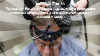 tms therapy irvine ca