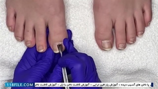 آموزش پدیکور-آموزش تصویری پدیکور-فیلم آموزش پدیکور-پدیکور پاهای آسیب دیده