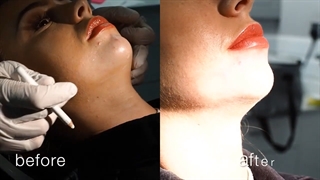 Principle & Basics of Smile Design -2