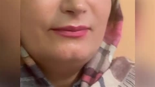 تجربه عمل بینی زیباجوی کلینیک دکتر سعید شیرنگی