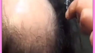 نحوه شستن موها و شامپو مناسب بعد از کاشت مو