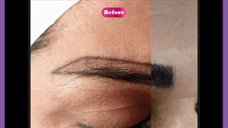 شستشو و استحمام بعد از کاشت ابرو