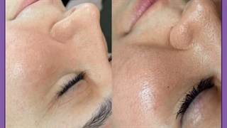 چگونه در دوران شیوع کرونا در خانه پاکسازی پوست انجام دهیم؟