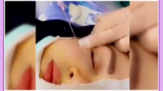 آنچه در مورد ژل آلیاکسین و ماندگاری آن مهم است بدانید!