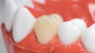 خدمات دندانپزشکی ترمیمی و زیبایی دندانها