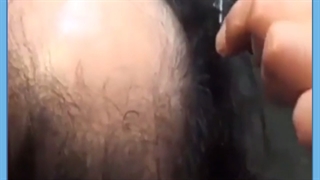 نحوه شستن موها و شامپو مناسب بعد از کاشت مو