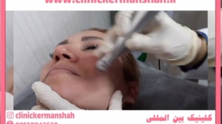 میکرودرم آبریژن روش غیرتهاجمی برای جوانسازی پوست