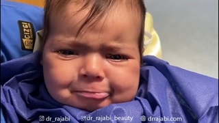 جراحی کلوبوم یا عدم تشکیل پلک بالا