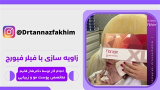 کانتورینگ و زاویه سازی صورت با تزریق فیلر