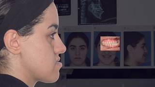 ارتودنسی و جراحی جلو بودن فک پایین | دکتر داودیان