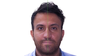 ارتودنسی و جراحی فک | دکتر داودیان