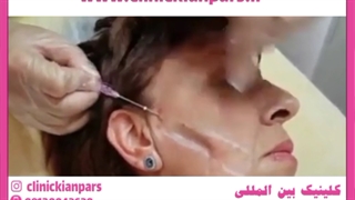 شادابی پوست زنان با بهترین روش های دکتر علیزاده