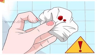 بواسیر یا هموروئید چیست؟ چگونه درمان میشود؟