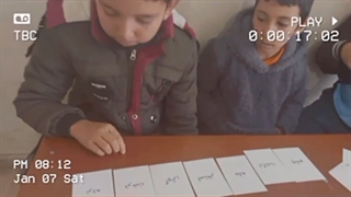 زهرا حیدری برداشتن زگیل