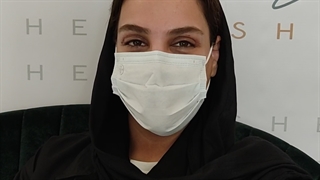 عمل بلفاروپلاستی پلک بالا و پلک پایین