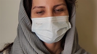 عمل بلفاروپلاستی پلک بالا و پلک پایین یا جراحی پلک پلک بالا و پلک پایین