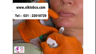 تزریق رووفیل اولترا به چانه