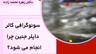 سونوگرافی کالر داپلر جنین چرا انجام مشود؟