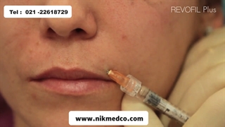 آموزش تزریق رووفیل پلاس به خط خنده