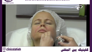 تزریق فیلر ترمیم ونیر