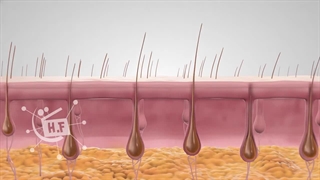 رهایی از موهای زائد بدن