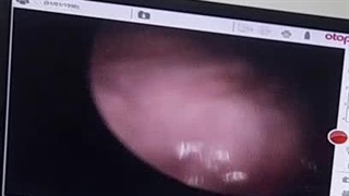 بهترین فوق تخصص حنجره در تهران، دکتر زهرا سرافراز