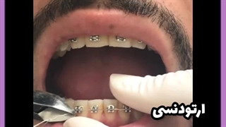 ارتودنسی اقساطی در اصفهان